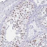 SCP3 Antibody in Immunohistochemistry (IHC)