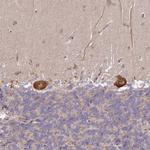 DOCK9 Antibody in Immunohistochemistry (Paraffin) (IHC (P))