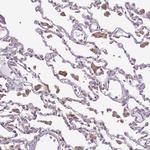 DOCK9 Antibody in Immunohistochemistry (Paraffin) (IHC (P))