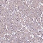 DOCK9 Polyclonal Antibody