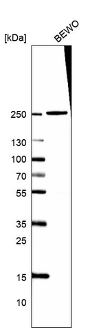 DOCK9 Antibody in Western Blot (WB)