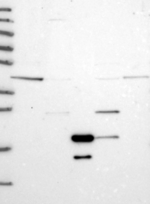 VPS36 Antibody in Western Blot (WB)