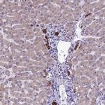 RPS26 Antibody in Immunohistochemistry (Paraffin) (IHC (P))