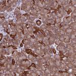RPS26 Antibody in Immunohistochemistry (Paraffin) (IHC (P))