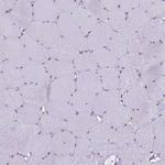 RPS26 Antibody in Immunohistochemistry (Paraffin) (IHC (P))