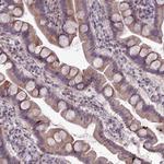 RPS26 Antibody in Immunohistochemistry (Paraffin) (IHC (P))