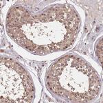 CDKN2AIPNL Polyclonal Antibody