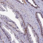 ZIP13 Antibody in Immunohistochemistry (Paraffin) (IHC (P))
