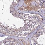 ZIP13 Antibody in Immunohistochemistry (Paraffin) (IHC (P))