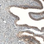 C5orf45 Antibody in Immunohistochemistry (IHC)