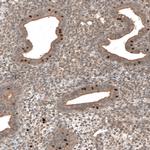 C5orf45 Antibody in Immunohistochemistry (IHC)