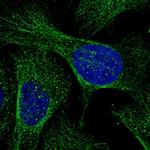 RHBDD3 Polyclonal Antibody