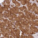 RHBDD3 Antibody in Immunohistochemistry (Paraffin) (IHC (P))