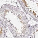 TEX37 Antibody in Immunohistochemistry (IHC)