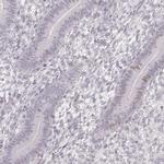 TEX37 Antibody in Immunohistochemistry (IHC)