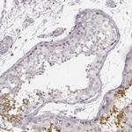 TEX37 Polyclonal Antibody