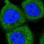 PPP6R1 Polyclonal Antibody