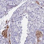 PPP6R1 Antibody in Immunohistochemistry (Paraffin) (IHC (P))