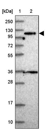 PPP6R1 Antibody in Western Blot (WB)