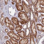 SOGA1 Antibody in Immunohistochemistry (Paraffin) (IHC (P))