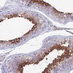 ZNF564 Antibody in Immunohistochemistry (Paraffin) (IHC (P))