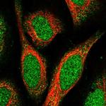 SPATA24 Antibody in Immunocytochemistry (ICC/IF)