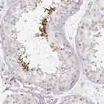 SPATA24 Antibody in Immunohistochemistry (IHC)