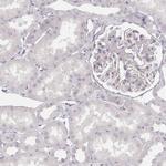 SPATA24 Antibody in Immunohistochemistry (IHC)