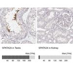 SPATA24 Antibody