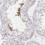 SPATA24 Antibody in Immunohistochemistry (IHC)
