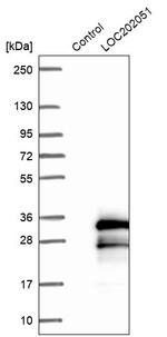 SPATA24 Antibody in Western Blot (WB)