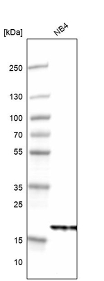 NDUFB6 Antibody in Western Blot (WB)