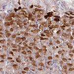 CP013 Polyclonal Antibody