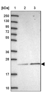 CP013 Antibody in Western Blot (WB)
