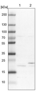CP013 Antibody in Western Blot (WB)