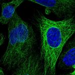 WWC2 Polyclonal Antibody