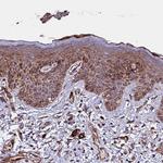 WWC2 Antibody in Immunohistochemistry (Paraffin) (IHC (P))