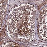 WWC2 Antibody in Immunohistochemistry (Paraffin) (IHC (P))