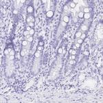 Splunc2 Antibody in Immunohistochemistry (IHC)