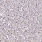 ANKRD50 Antibody in Immunohistochemistry (Paraffin) (IHC (P))