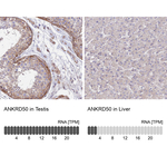 ANKRD50 Antibody in Immunohistochemistry (Paraffin) (IHC (P))