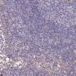 ANKRD50 Antibody in Immunohistochemistry (Paraffin) (IHC (P))