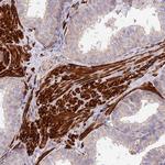ANKRD50 Antibody in Immunohistochemistry (Paraffin) (IHC (P))