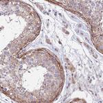 ANKRD50 Antibody in Immunohistochemistry (Paraffin) (IHC (P))