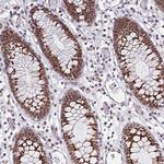THOC3 Antibody in Immunohistochemistry (Paraffin) (IHC (P))