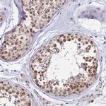 THOC3 Polyclonal Antibody