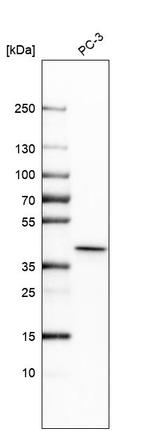 THOC3 Antibody in Western Blot (WB)