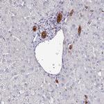 POLR2J Polyclonal Antibody