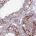 C19orf57 Antibody in Immunohistochemistry (Paraffin) (IHC (P))
