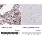 C19orf57 Antibody in Immunohistochemistry (IHC)